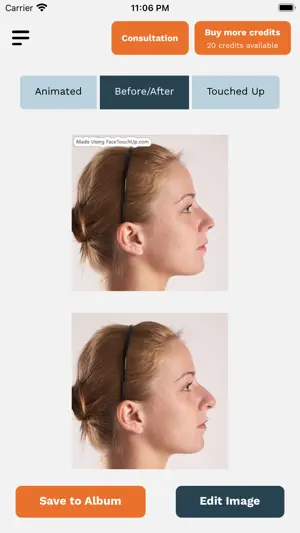 FaceTouchUp Nose Job Simulator截图6